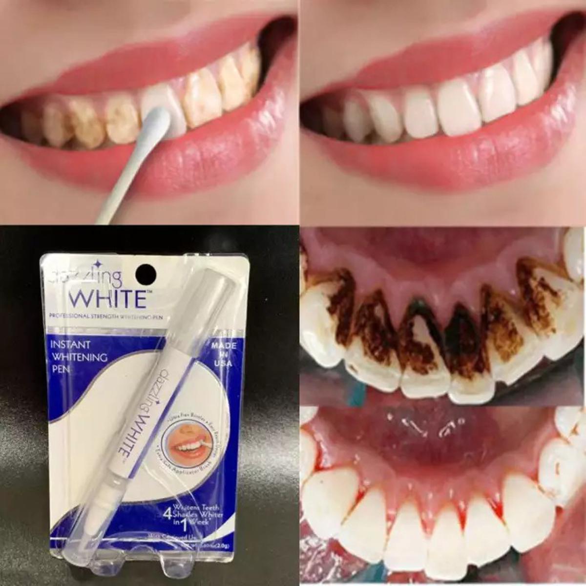 Teeth Whitening Pen For Plaque And Stains Removal