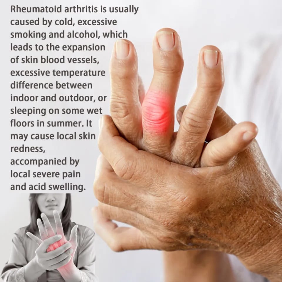 30ml Vein Healing Varicose Veins Treatment Spray Essential Oil Relief Phlebitis Angiitis Remedy Pain Spray Relief Leg Pain Spine Pain