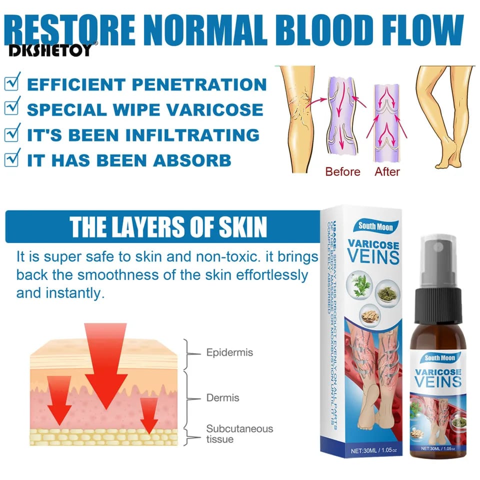 30ml Vein Healing Varicose Veins Treatment Spray Essential Oil Relief Phlebitis Angiitis Remedy Pain Spray Relief Leg Pain Spine Pain