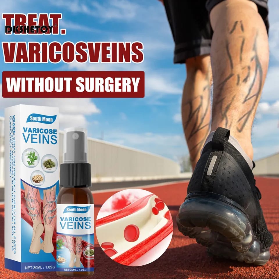 30ml Vein Healing Varicose Veins Treatment Spray Essential Oil Relief Phlebitis Angiitis Remedy Pain Spray Relief Leg Pain Spine Pain