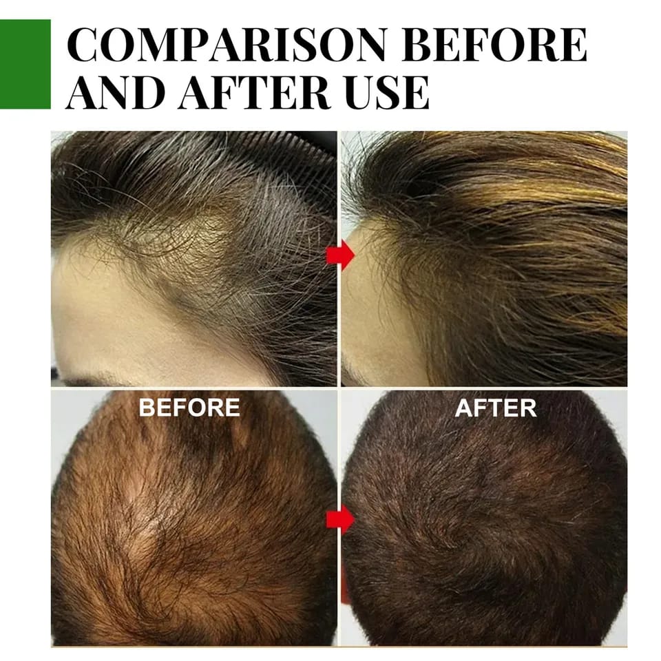 30ML Rosemary Essential Oil Hair Growth Oils Pure Natural 30ML Hair Essential Oils For Nourish Shiny Hair Healthy Hair Care