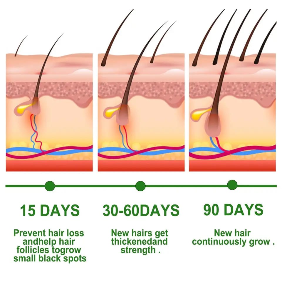 30ML Rosemary Essential Oil Hair Growth Oils Pure Natural 30ML Hair Essential Oils For Nourish Shiny Hair Healthy Hair Care