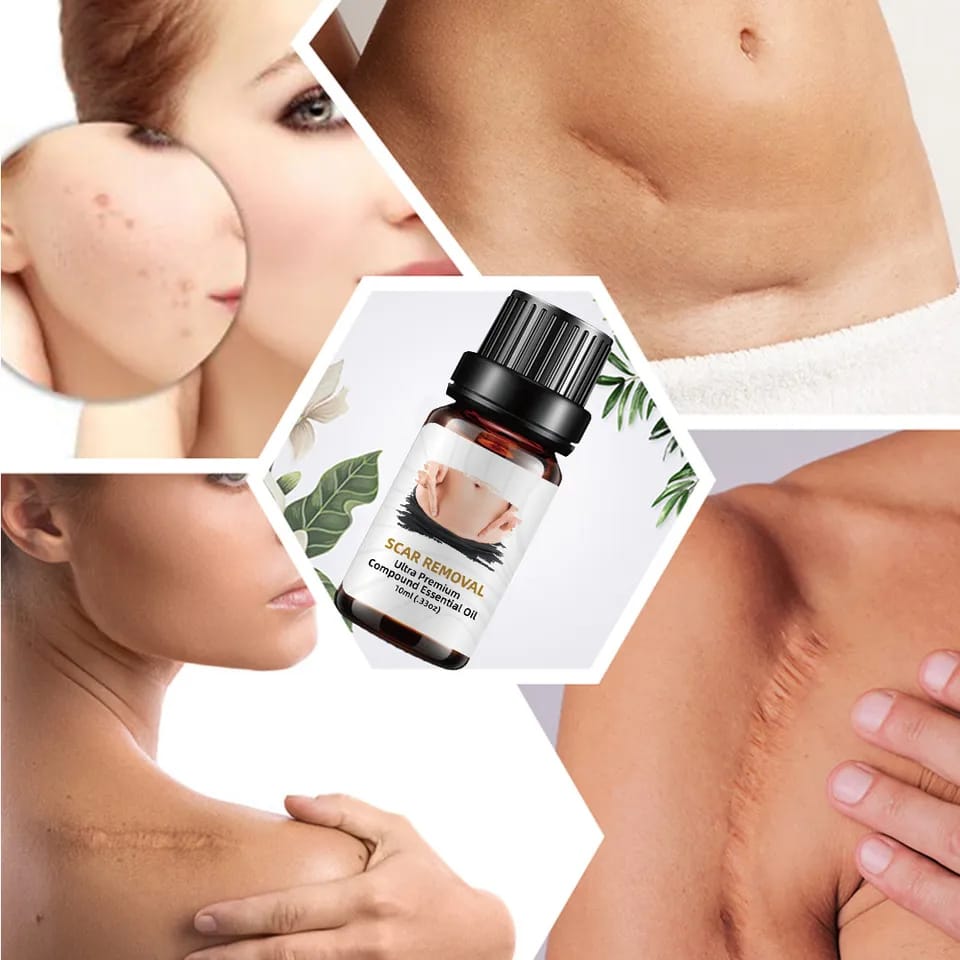 10ml Scar Removal Essential Oil Ultra Premium Compound Essential Oils for Massage Face Body Skin Care Scars Repair Acne Burn