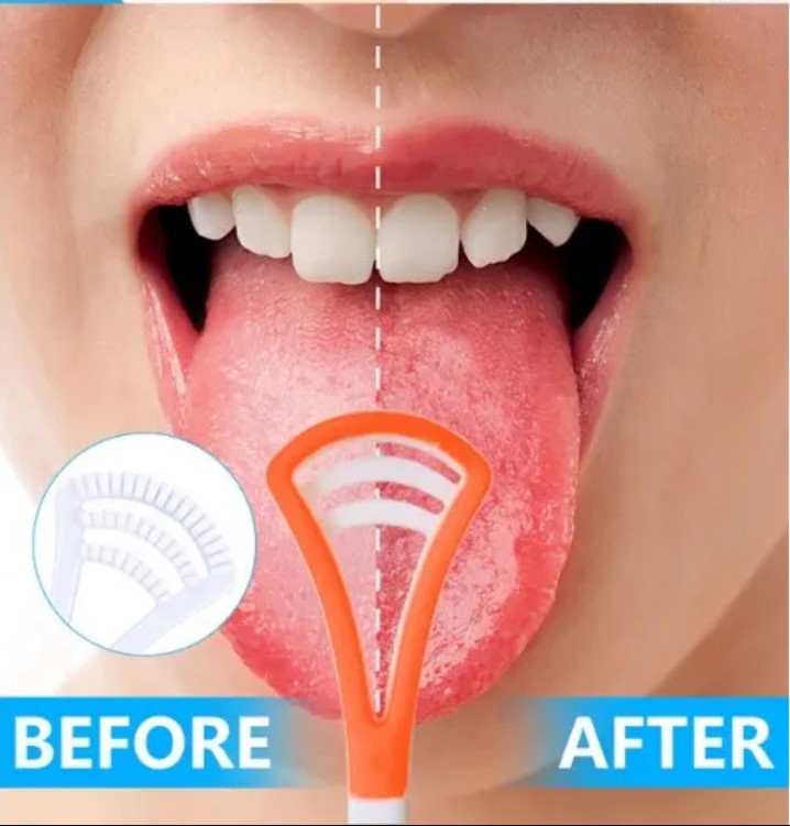Tongue Scraper Tongue Cleaner Brush Antibacterial Zaban Cleaner Toothbrush Mouth Dental Care Brush Bad Breath Oral Fresher Hygiene Tools Deep Clean For Oral Health Use After Toothbrush For Fresh Breath
