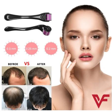Skin Therapy Derma Roller With 540 Micro Needles- For Men And Women