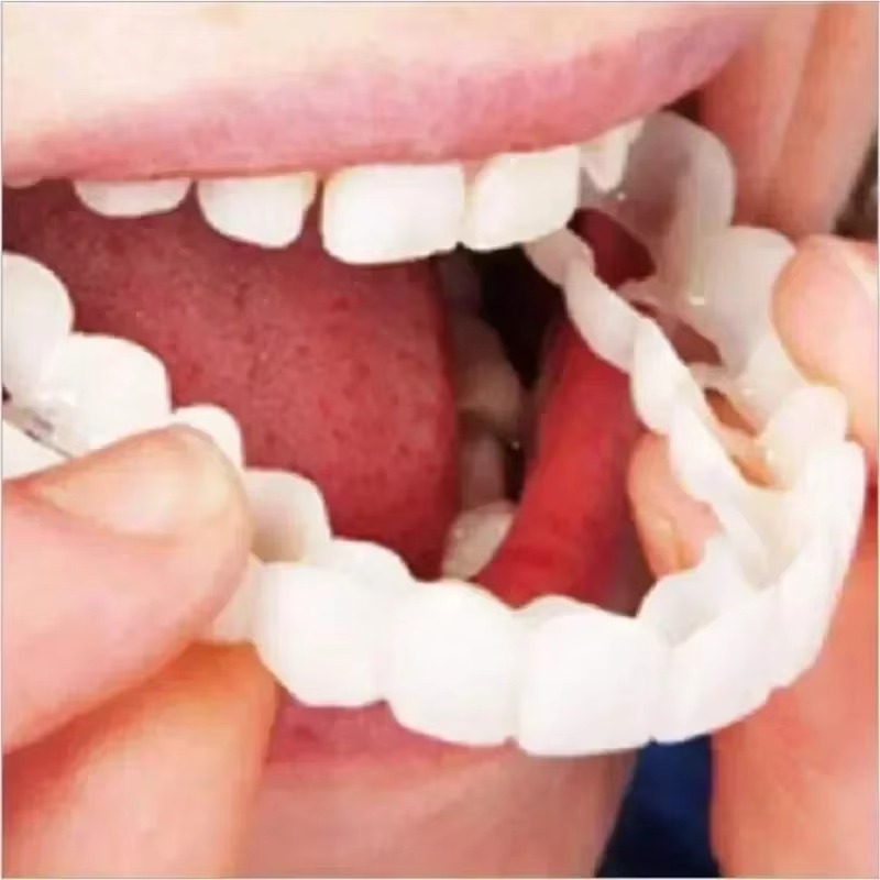 1Pair Adjustable Dental Veneers Unisex Teeth Veneer for Men and Women