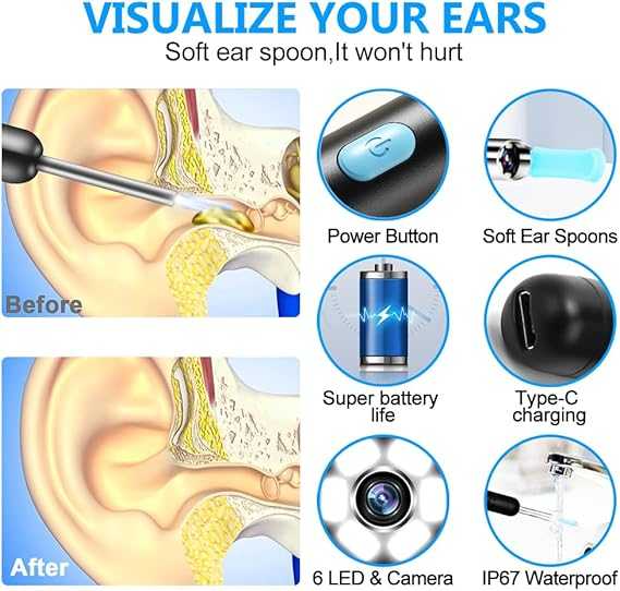 Smart Visual Ear Cleaner – HD Camera Ear Wax Removal Tool with LED Light