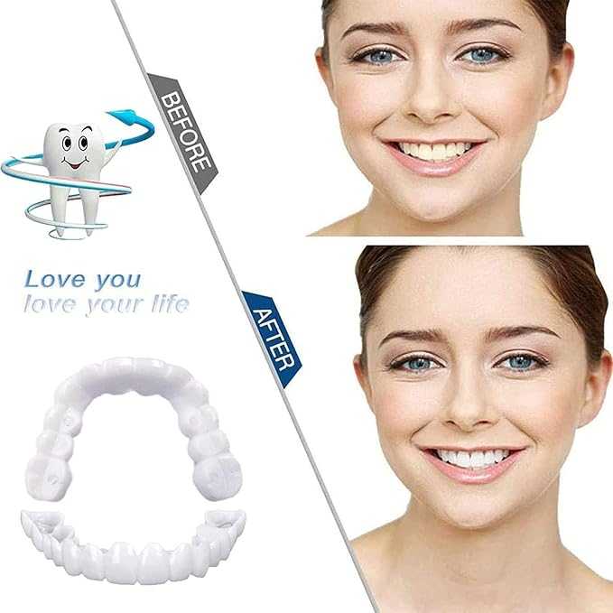 Snap On Smile Veneers Instant Teeth Cover – Temporary Cosmetic Fake Teeth