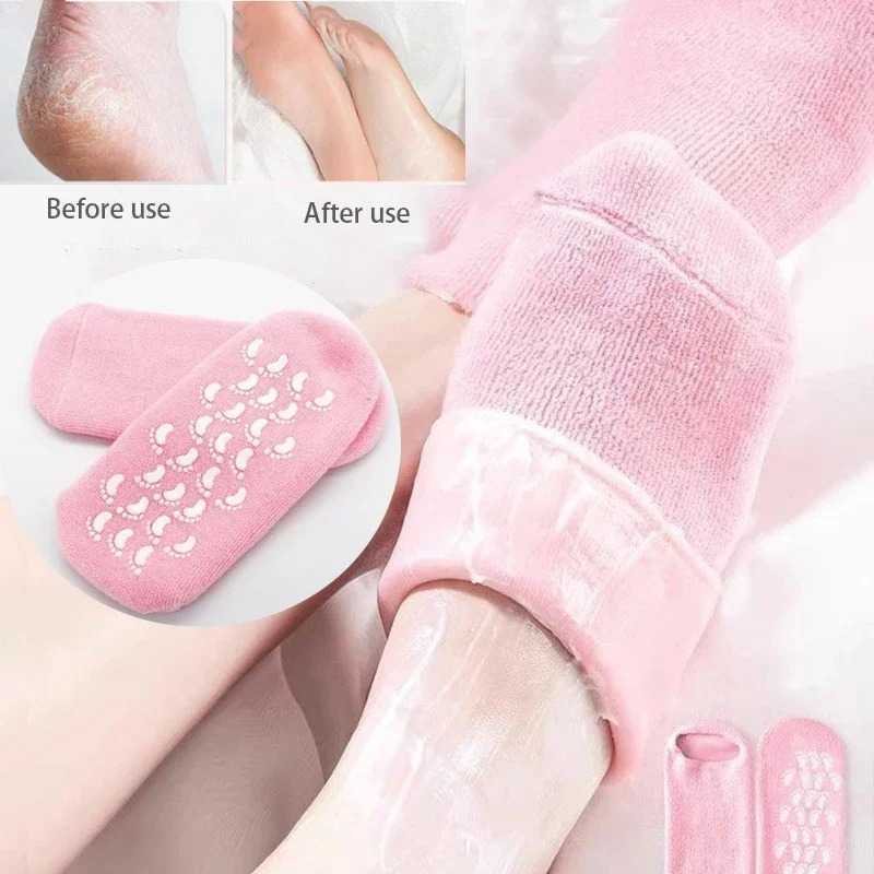 Silicone Gel Heel Socks — Moisturizing Foot Care for Cracked Heels, Callus Relief, and Soft Skin