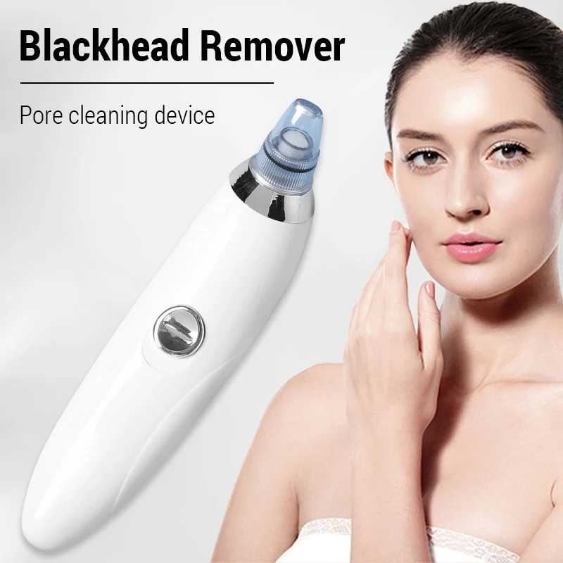Electric Blackhead Remover — Pore Vacuum for Deep Face Cleansing and Clearer Skin